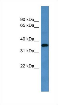 Anti-GPR88 antibody produced in rabbit