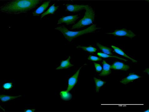 Anti-MAGED1 antibody produced in rabbit