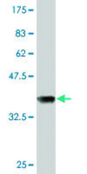 Monoclonal Anti-NDUFV1 antibody produced in