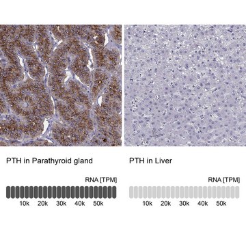 Anti-PTH antibody produced in rabbit