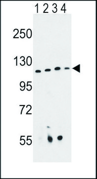 ANTI-RPGRIP1 (CENTER) antibody produced in