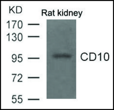 Anti-CD10 antibody produced in rabbit