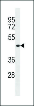 ANTI-AURORA-C (CENTER) antibody produced in
