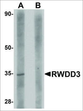 Anti-RWDD3 antibody produced in rabbit