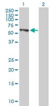 Anti-EPHX2 antibody produced in mouse