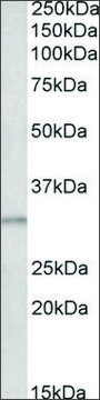 Anti-AES (N-terminal) antibody produced in