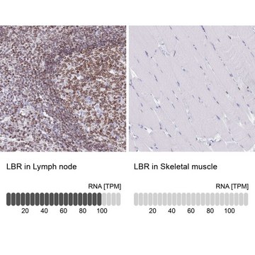 Anti-LBR antibody produced in rabbit