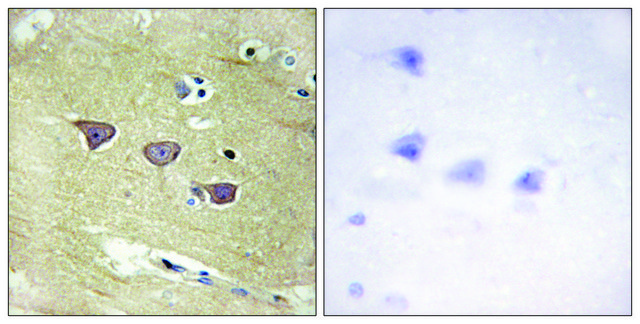 Anti-CAMK5 antibody produced in rabbit