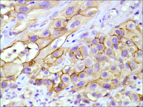 Anti-Mesothelin antibody, Rabbit monoclonal