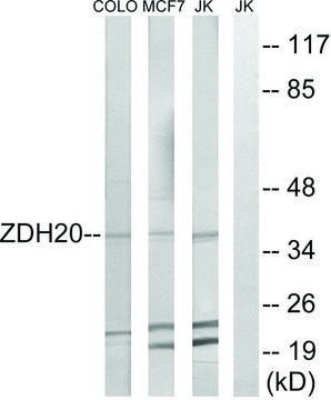 Anti-ZDHHC20 antibody produced in rabbit