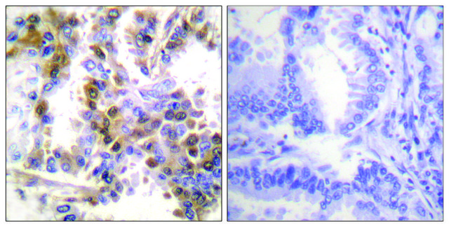 Anti-4E-BP1 antibody produced in rabbit