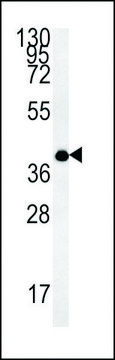ANTI-TM111 (N-TERMINAL) antibody produced in