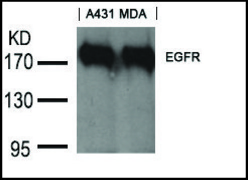 Anti-EGFR (Ab-1197) antibody produced in