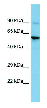 Anti-ERVW-1 (N-terminal) antibody produced in