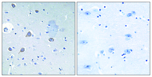 Anti-p70 S6 Kinase antibody produced