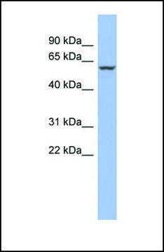 Anti-PPARA, (N-terminal) antibody produced in