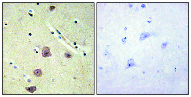 Anti-AK5 antibody produced in rabbit