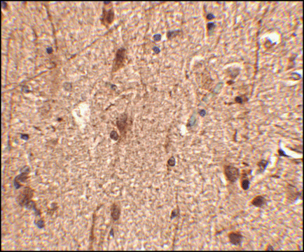 Anti-Slitrk3 antibody produced in rabbit