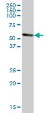 Anti-ALDH1A1 antibody produced in mouse