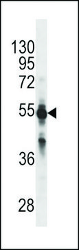 MONOCLONAL ANTI-CYP2C9 (N-TERMINAL) antibody produced