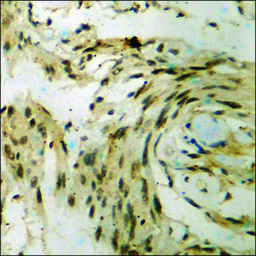 Anti-phospho-p70 S6 Kinase (pSer?²?) antibody