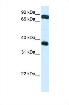 Anti-GP6 antibody produced in rabbit
