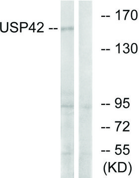 Anti-USP42 antibody produced in rabbit