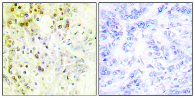 Anti-Cyclin L2 antibody produced in
