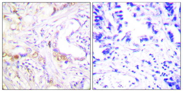 Anti-PIAS3 antibody produced in rabbit
