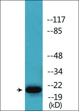 Anti-phospho-HP1 ? (pSer?³) antibody produced
