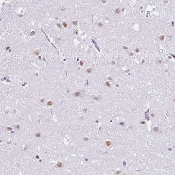 Anti-DCAF17 antibody produced in rabbit