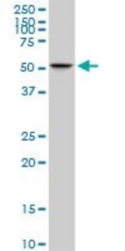 Monoclonal Anti-C10orf81 antibody produced in