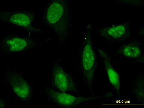 Monoclonal Anti-ZNF181 antibody produced in