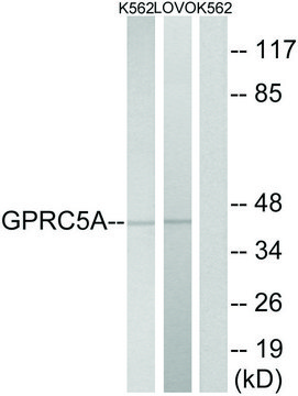 Anti-GPRC5A antibody produced in rabbit