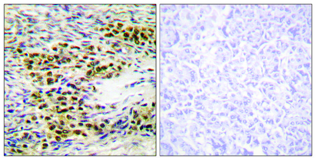 Anti-AKT antibody produced in rabbit
