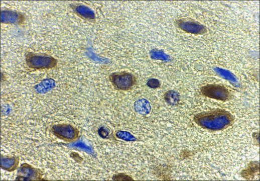 Anti-Adiponectin (ab1) antibody produced in