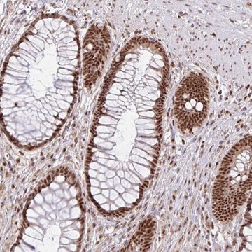 Anti-LKAAEAR1 antibody produced in rabbit