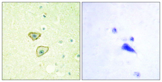 Anti-EGFR antibody produced in rabbit