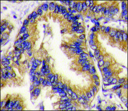 Anti-GCAP3 (C-term) antibody produced in
