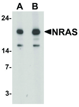 Anti-N-RAS antibody produced in rabbit