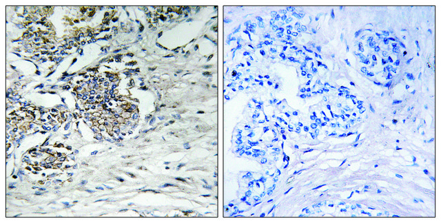 Anti-Claudin 7 antibody produced in