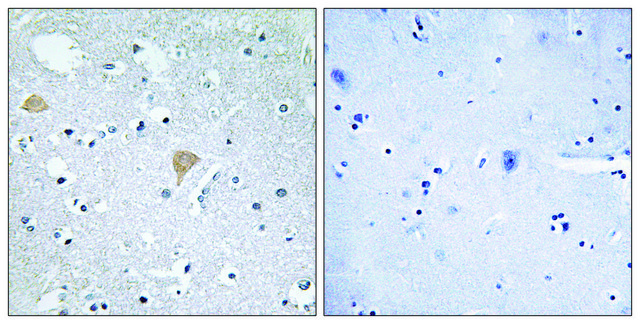 Anti-CTRO antibody produced in rabbit
