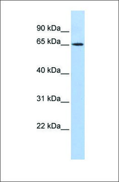 Anti-WT1 antibody produced in rabbit