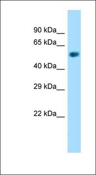 Anti-NAPRT1 antibody produced in rabbit