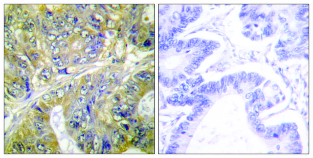 Anti-EPS8L3 antibody produced in rabbit
