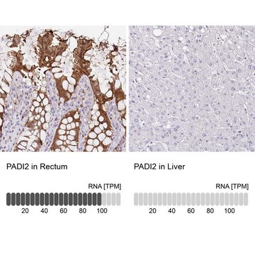 Anti-PADI2 antibody produced in rabbit