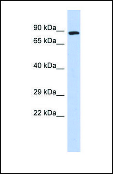Anti-ZFYVE20, (N-terminal) antibody produced in