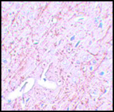 Anti-GATA3 antibody produced in rabbit