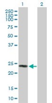 Anti-MREG antibody produced in rabbit