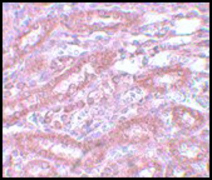 Anti-ENC-1 antibody produced in chicken